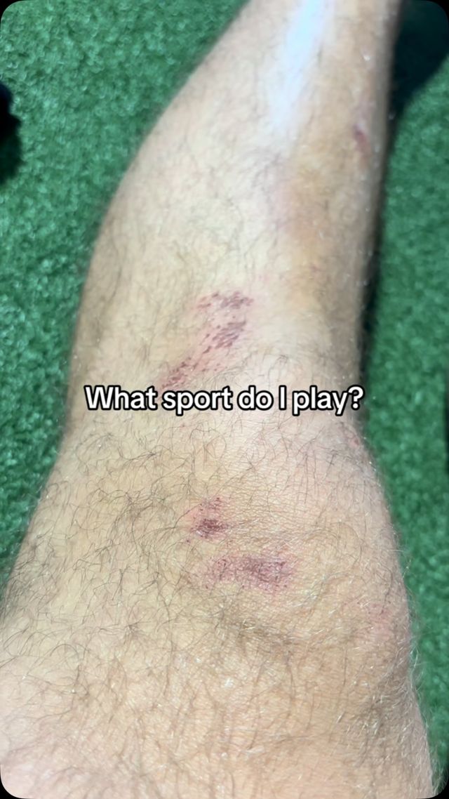 Take a guess